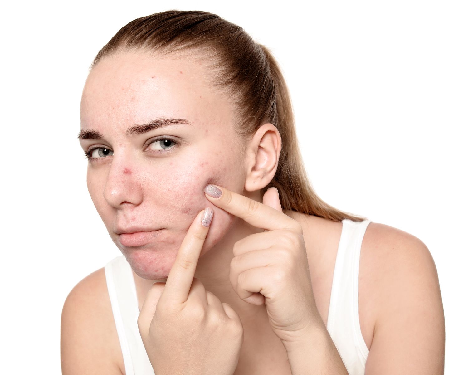 Blemish-free, clear skin.