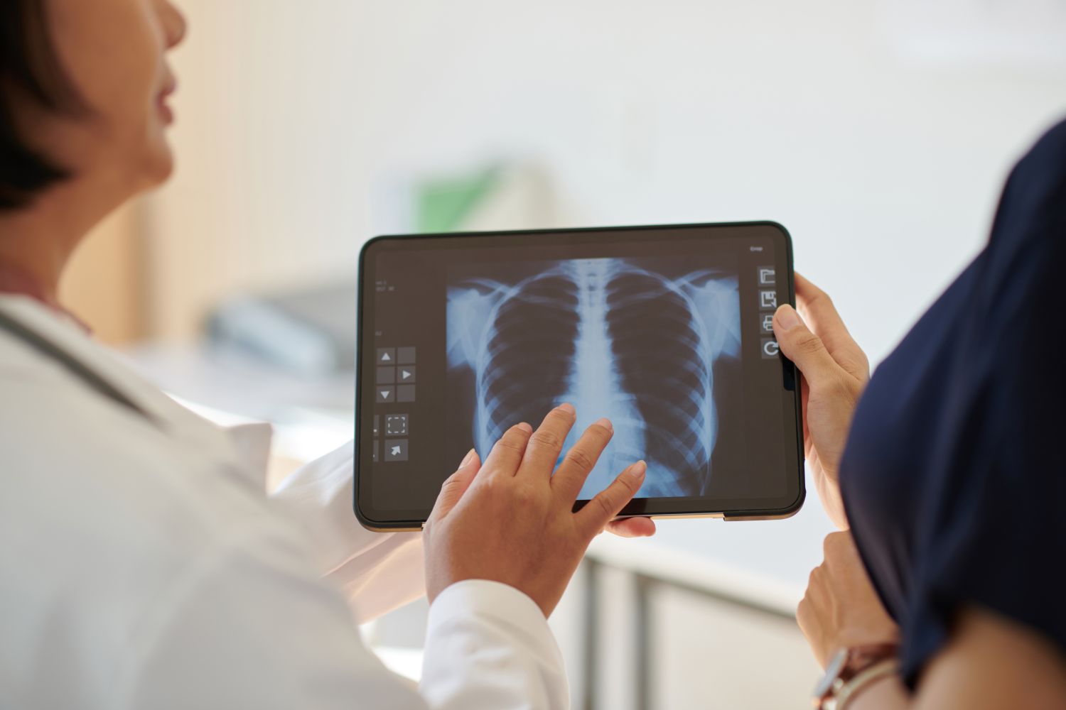 Pneumonia